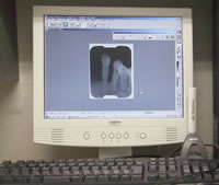 デジタルレントゲン